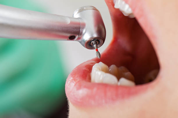 Best Tooth Infection Emergency Dentist  in Tokeneke, CT